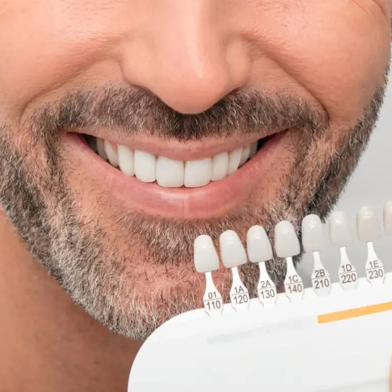 Onley (Porselen Dolgular)